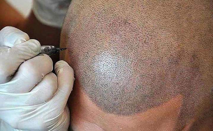 Formation esthétique Gatineau